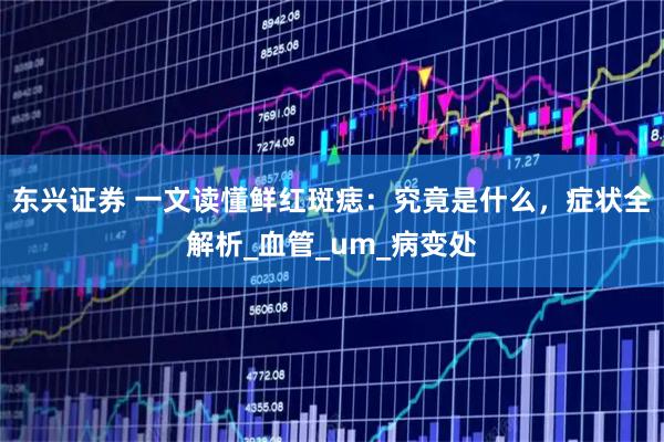 东兴证券 一文读懂鲜红斑痣：究竟是什么，症状全解析_血管_um_病变处